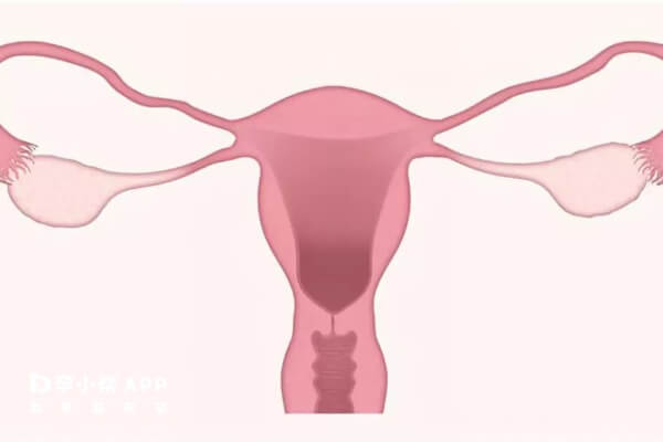 宫腔积液需治疗后才能试管助孕
