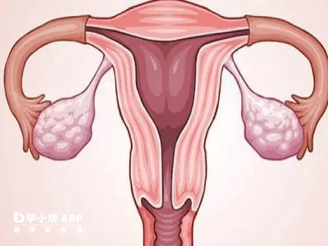 女性宫寒试管移植会影响胚胎着床