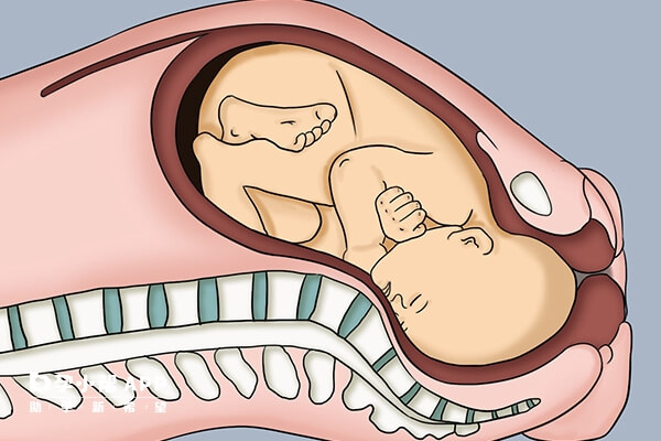 看清楚二胎全入盆和半入盆图片,感觉和肚型是主要区别
