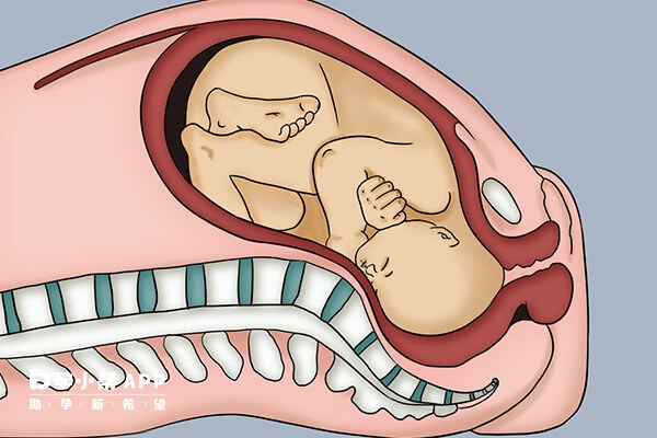 胎儿半入盆的状态