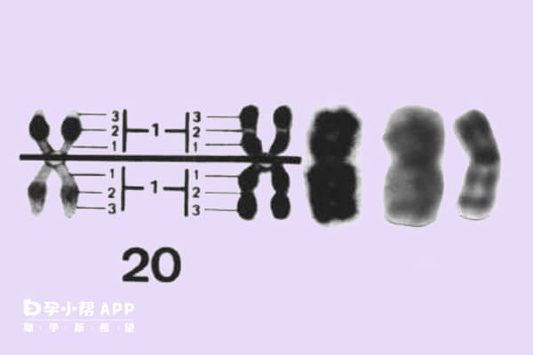 20号染色体