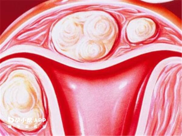 女人子宫内膜真实图片图片