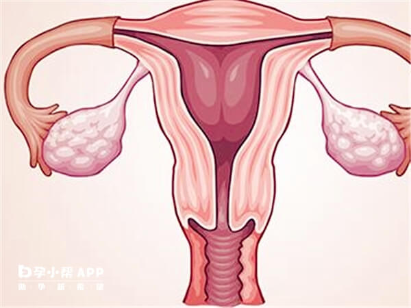 子宫内膜异位症术后可以肌肉注射达菲林