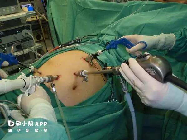 宫腹腔镜手术易致气体栓塞