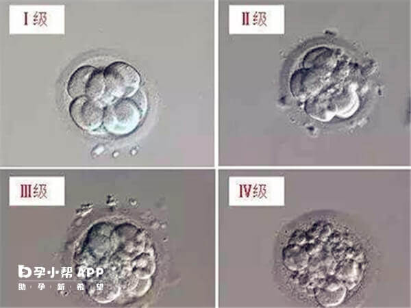 二级胚胎是优质胚胎可移植
