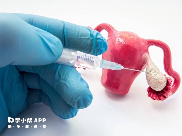唐山市人民医院可治疗多囊卵巢综合征