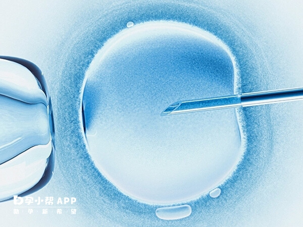 卵巢早衰在扬州做供卵都是需要排队的