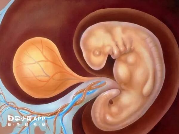 大多唐氏儿是受孕时形成的