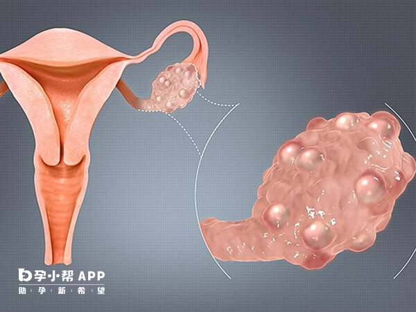月经第四天一般有5-12个窦卵泡是正常的
