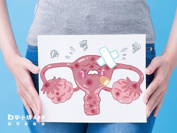 子宫腺肌症不能直接移植胚胎