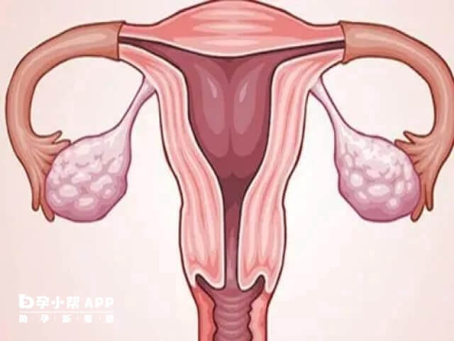 冻胚移植前可通过药物调理子宫