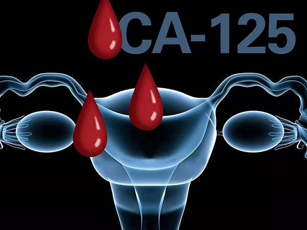 ca125偏高会影响宫腔环境