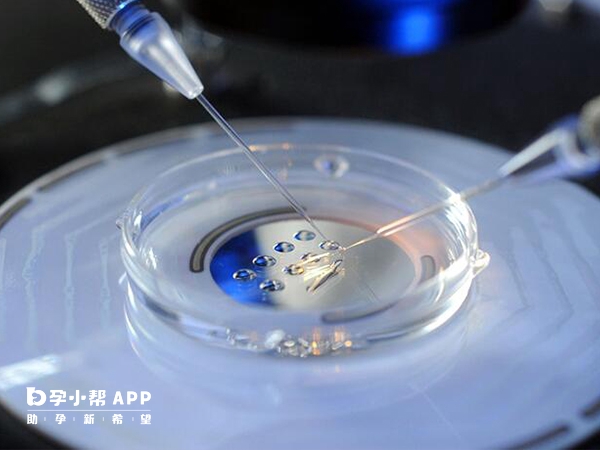 试管一般移植1个胚胎