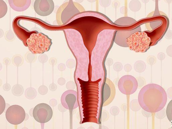 子宫内膜异位性不孕症表现须知，治疗手段除手术外还有4种