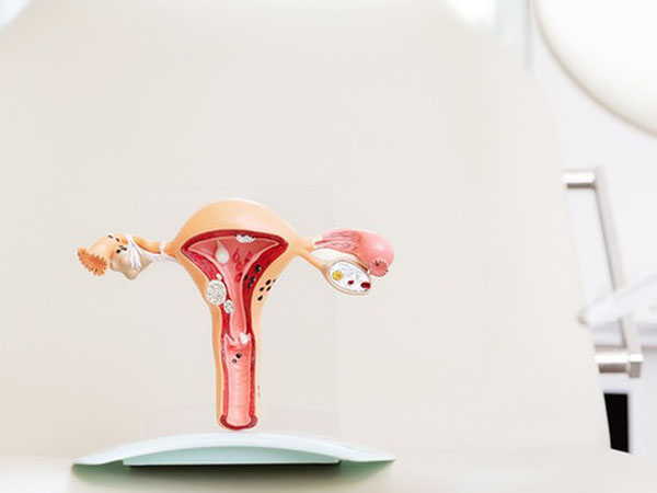 宫腔粘连试管婴儿指南，定期妇科检查不可少！