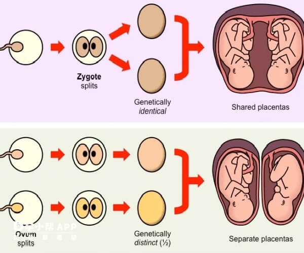 同卵和异卵双胎外貌不同