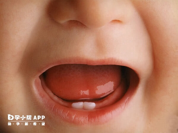 苏州儿童医院有没有牙科