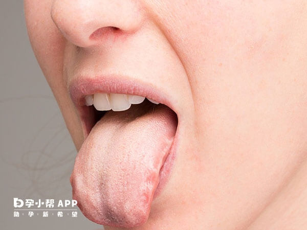 胚胎移植后舌头发白怎么缓解