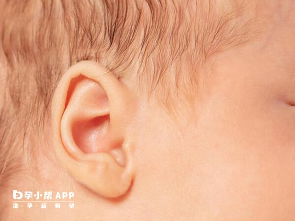 三个月的宝宝头部发育标准
