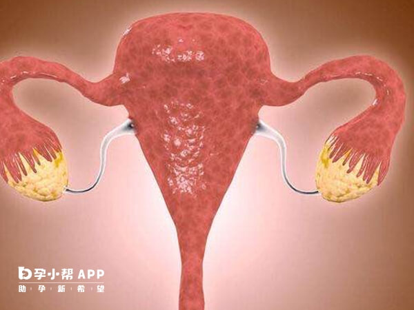 子宫内膜异位有哪些表现