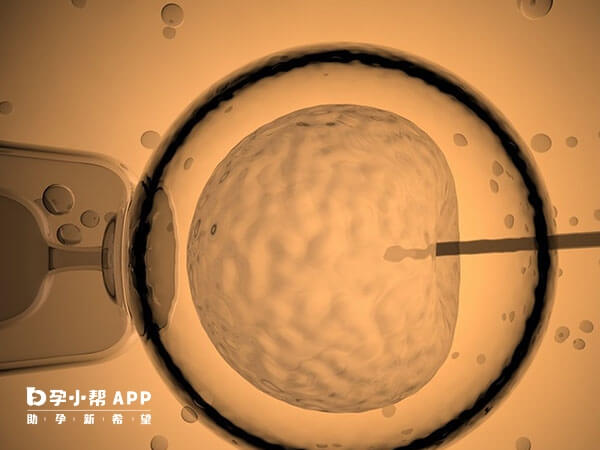 上海比较出名的不孕不育医院
