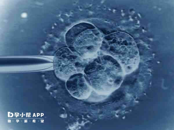 北京妇产医院做试管婴儿能生育双胞胎