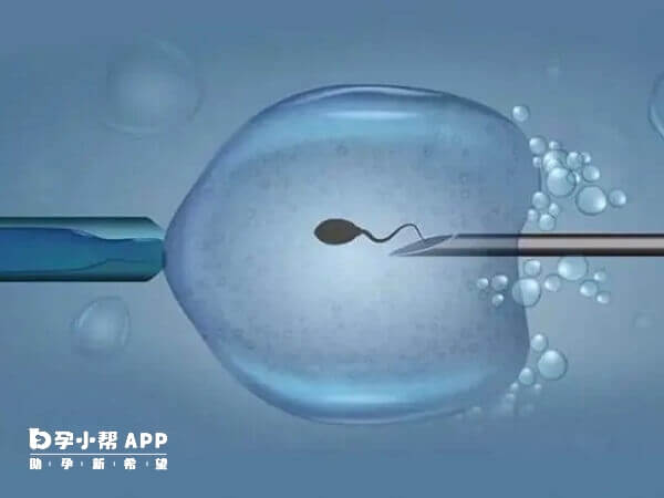 上海国妇婴能做第三代试管婴儿