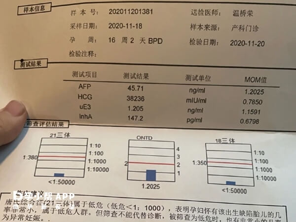 三代试管唐筛临界风险会不会生唐宝