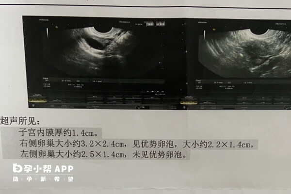 内膜厚度0.8cm 适不适合移植